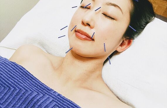 アンチエイジングは体質改善から｜通いやすい美容鍼はMilagroはり灸院